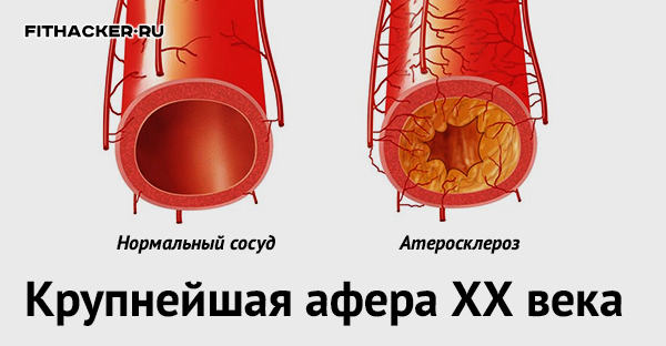 Наука. Kрупнейшая афера XX века